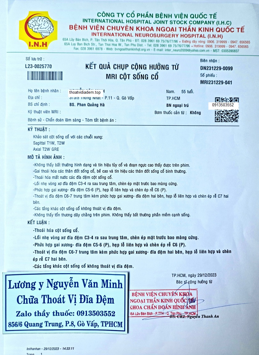 Thoát vị đĩa đệm cột sống cổ